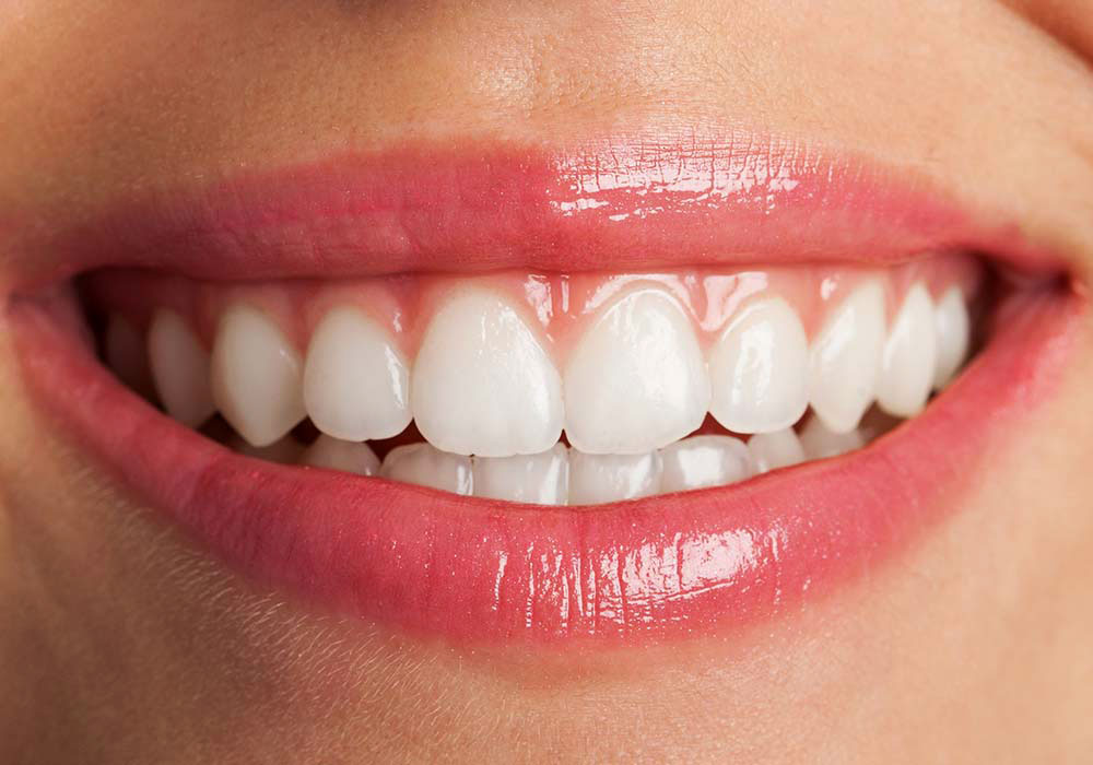 Plástica periodontal